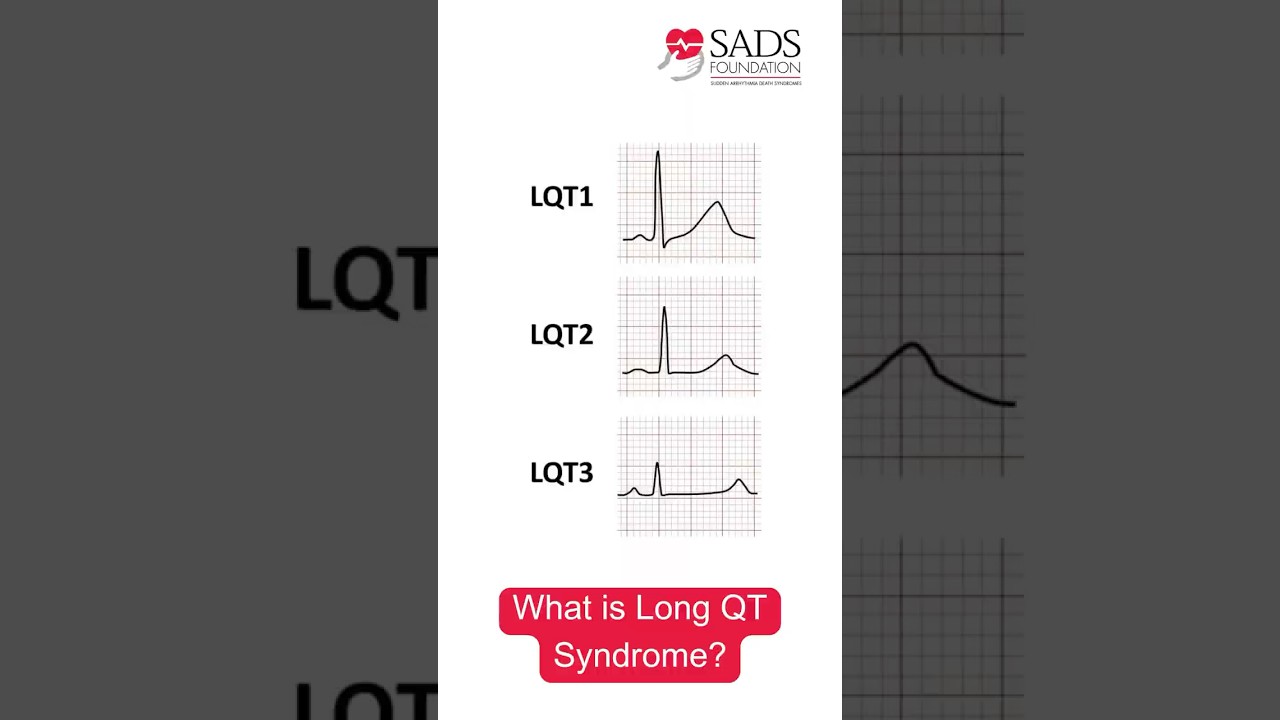 What is Long QT Syndrome?