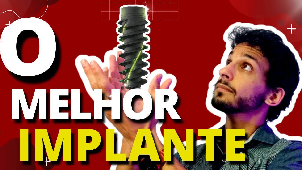 Qual é o Melhor Implante Dentário