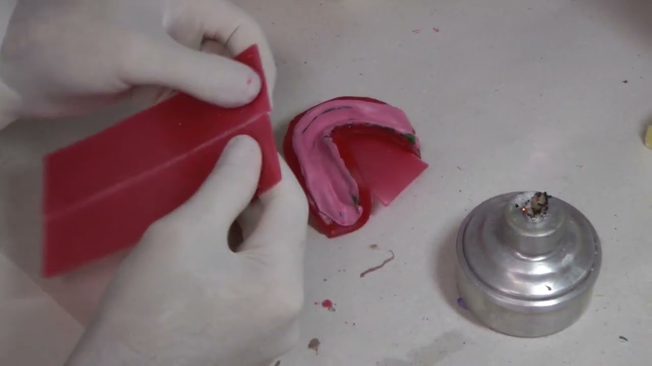 Filme 14   Encaixotamento molde Inferior - Protese Total