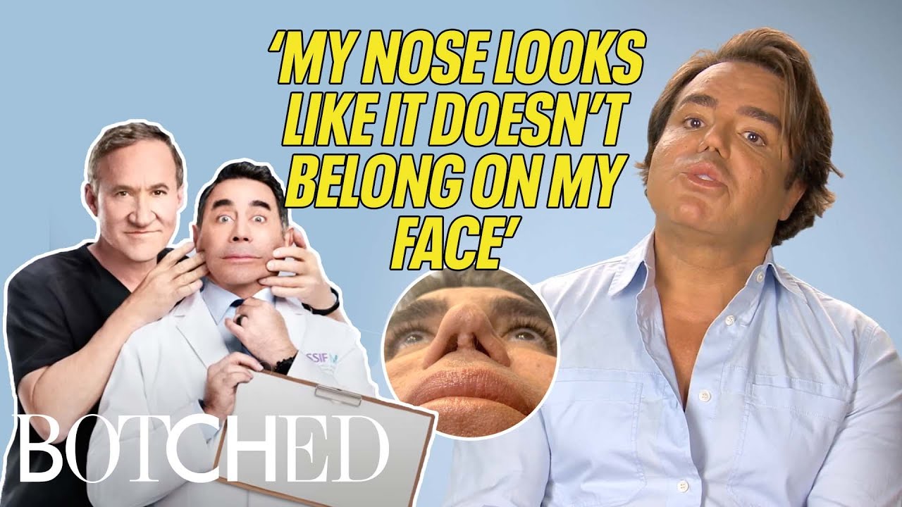 Sammy is a Lebanese Pop Star With A Small, Broken Nose (Before & After) | Botched | E!