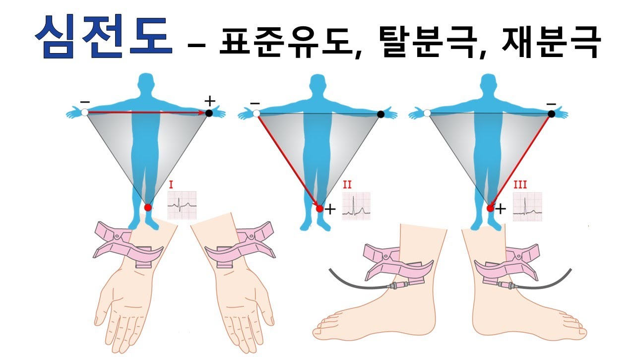 심전도 - 표준유도, 탈분극, 재분극