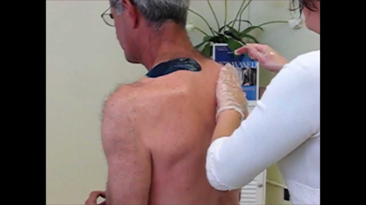 Cirepil Waxing Demo - Mens Back Wax using Blue Hard Wax
