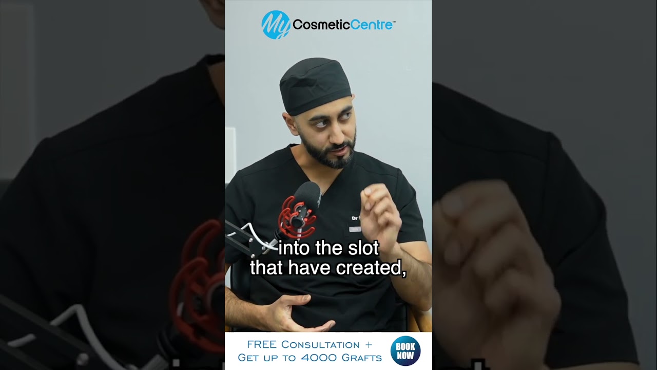 FUE Hair Transplant UK &ndash; Full Procedure Explained Step-by-Step by Hair Surgeon