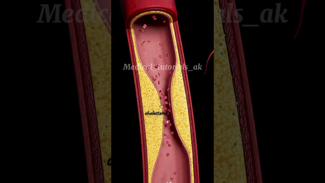 How are blood clots formed ??         #biology #medicalstudent #medicalknowledgeonline #who