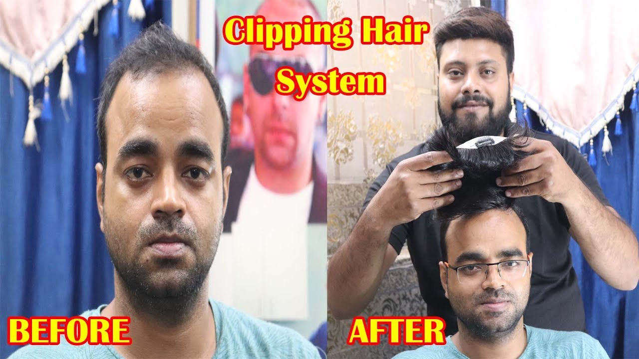 Interesting clipping hair system for men | by Abdul Rahman | whats aap no - 9873152223