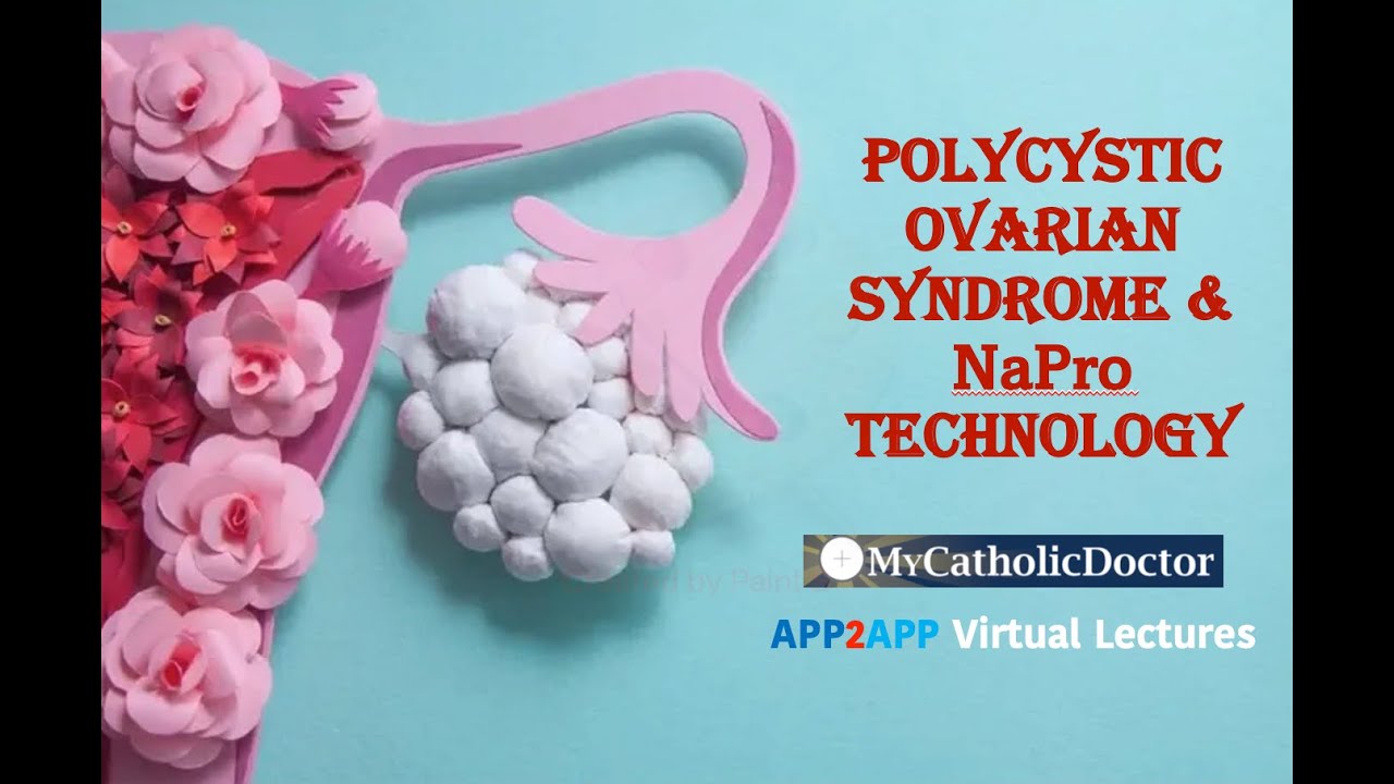 Polycystic Ovarian Syndrome & NaPro Technology