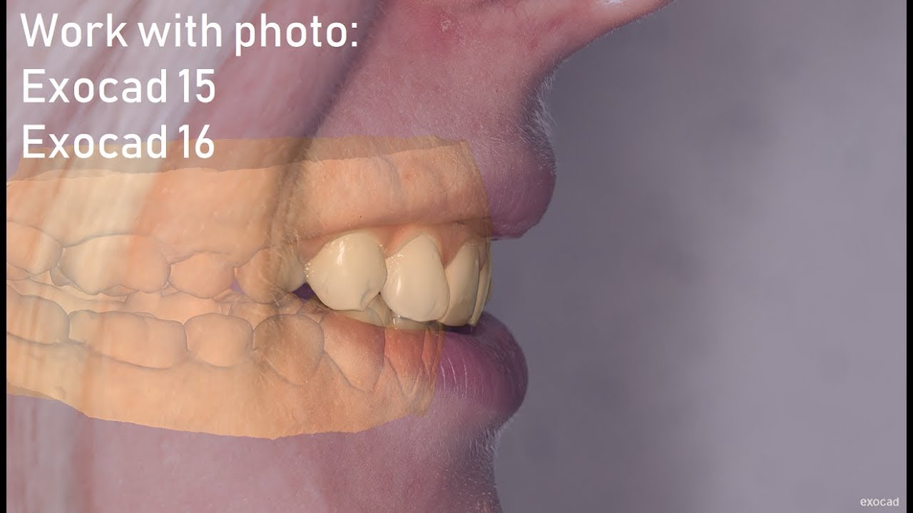 Photo import Exocad(15,16 versions)/ Импорт фото в версии 15 и 16