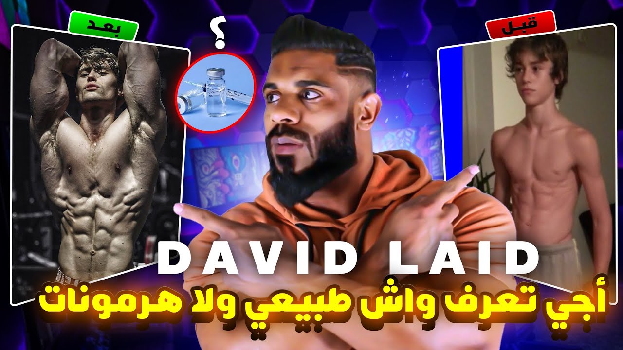 سلسلة هل هم طبيعيون 🤔 ؟ : David Laid  واش مستوى طبيعي