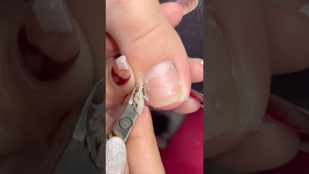 Lots of cuticles and dry skin #pedicure #nails #nailcare #satisfying #toenails