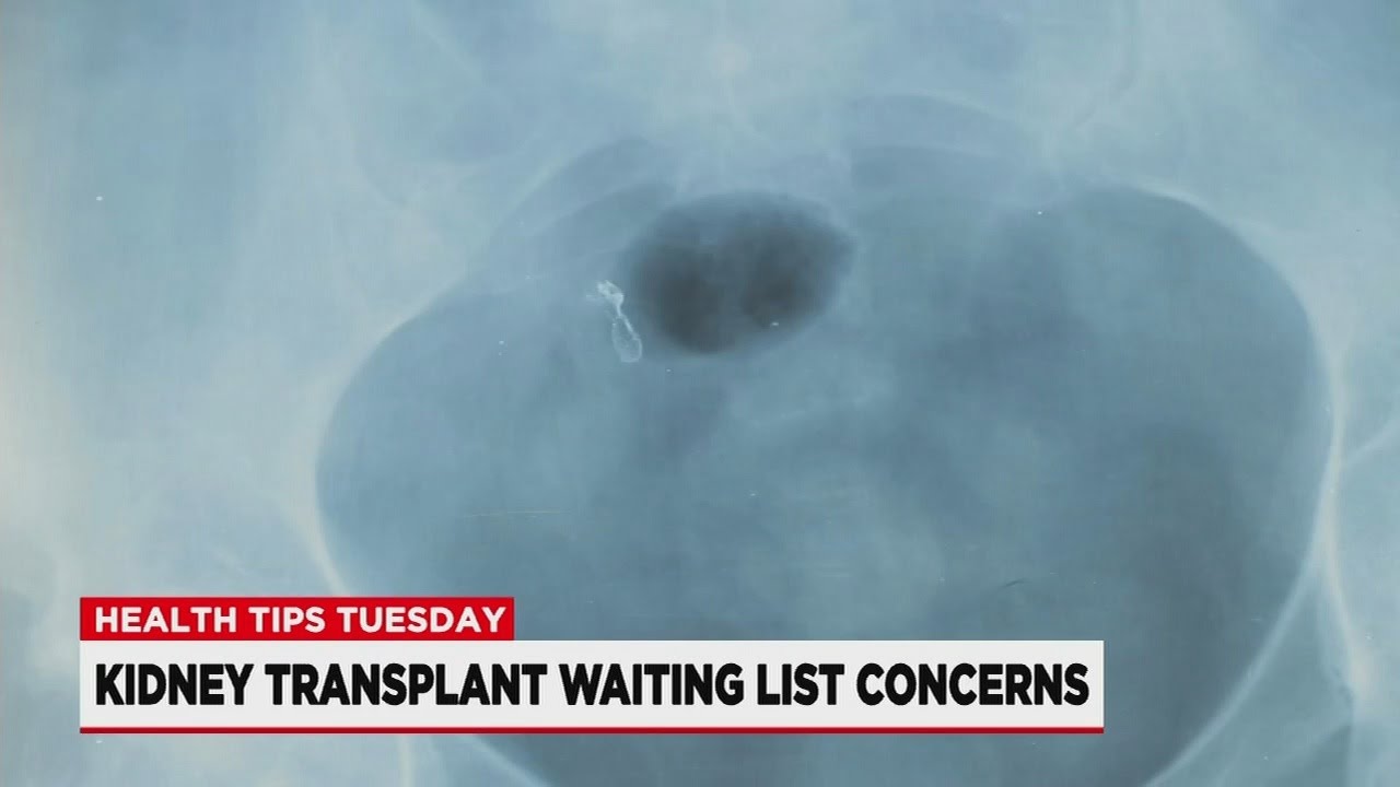 Health Tips Tuesday: kidney transplant waiting list concerns