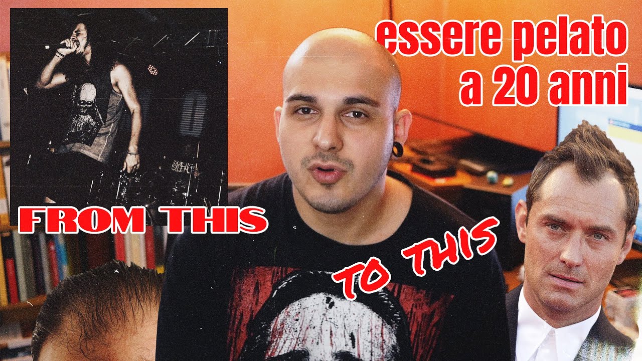 ESSERE PELATO a 20 anni 👨‍🦲 [STORYTIME]