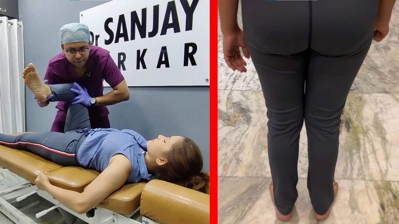 KNOCK KNEE Transformation CHIROPRACTIC Techniques for Knee Alignment