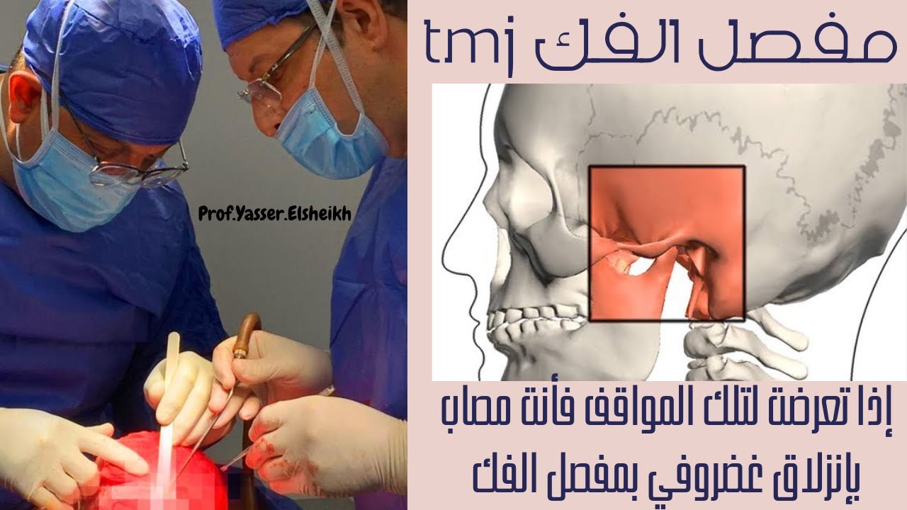 قد تكون مصاب بإنزلاق غضروفي بمفصل الفك وأنت لا تعلم .!