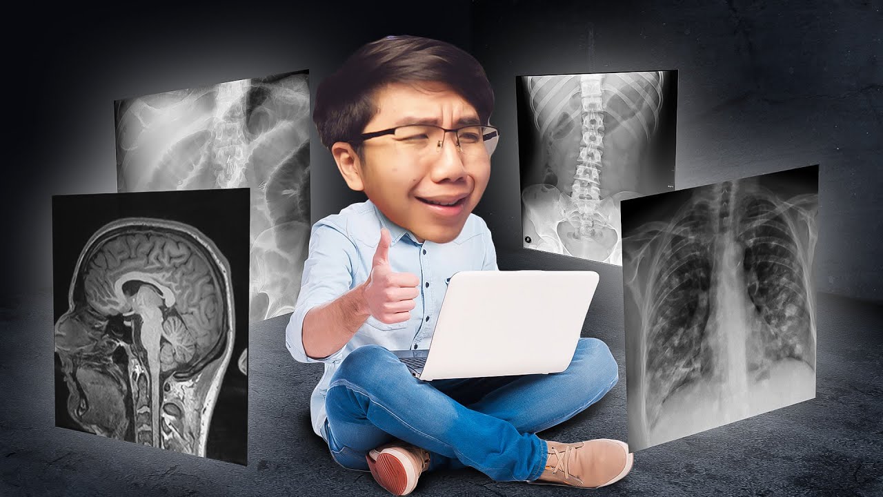 ผมพาคุณลองอ่านฟิล์ม Xray ( ของจริง )