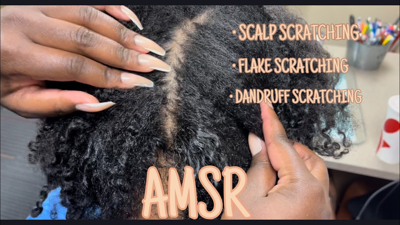 ASMR | DANDRUFF SCRATCHING ~ FLAKES ~ SCALP MASSAGE | REAL PERSON