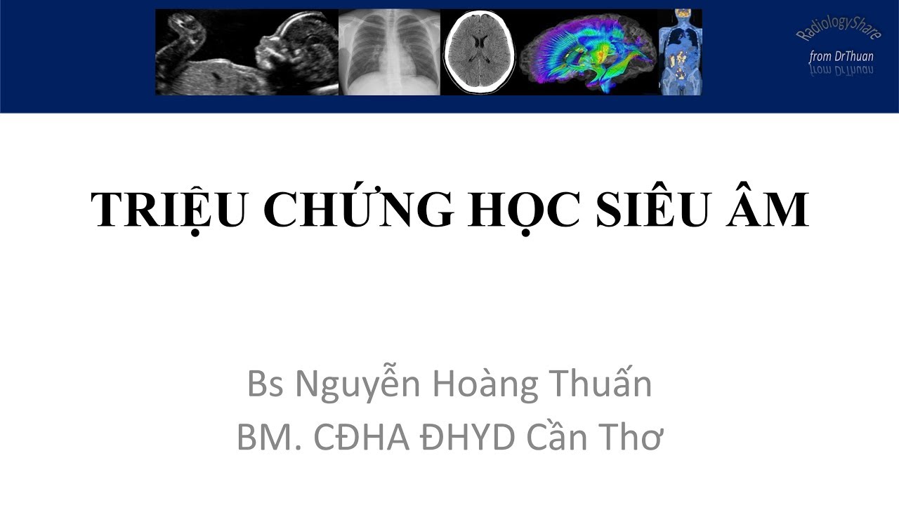 Triệu Chứng Học Siêu Âm