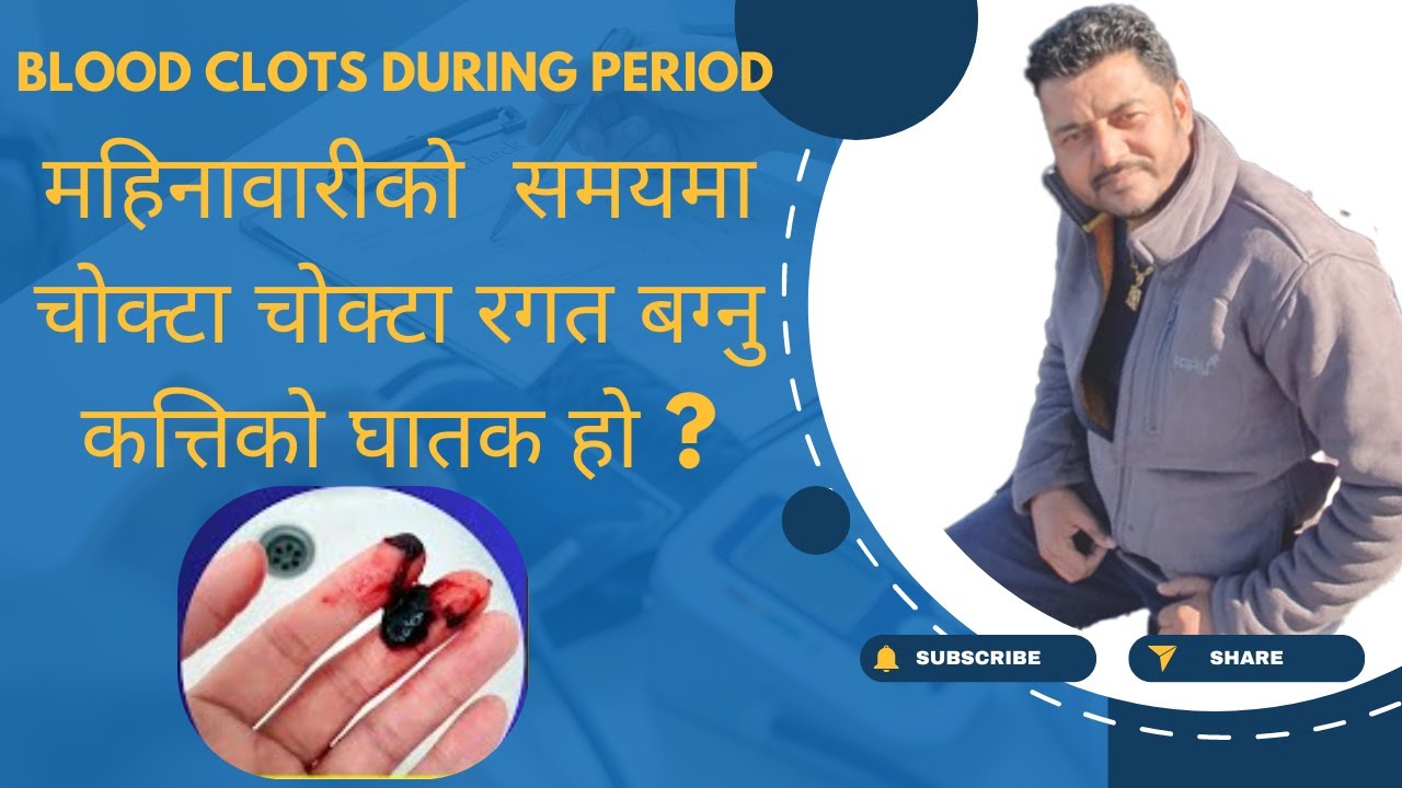महिनावारीको  समयमा चोक्टा चोक्टा रगत बग्नु कत्तिको घातक हो ? blood clots during period