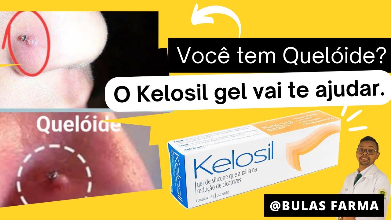 KELOSIL GEL - Como usar ? Para que serve?