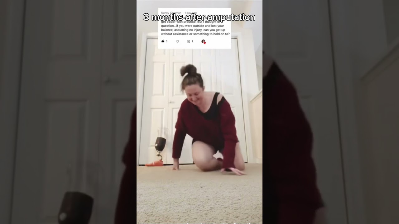 How to Stand After #electiveamputation | Complete Amputee Q&A Guide