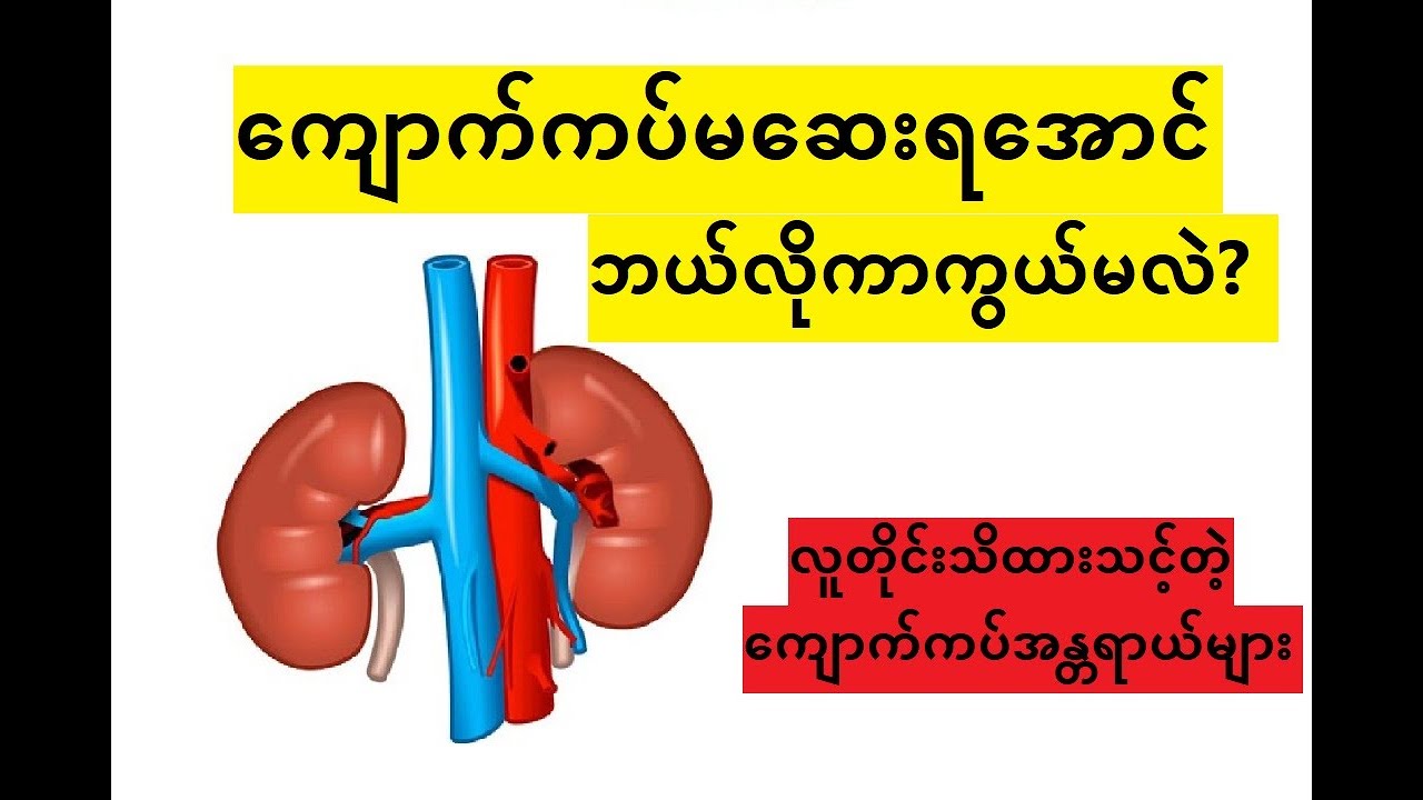 ကျောက်ကပ်ဆေးတဲ့အဆင့်ထိ မရောက်အောင် ဘယ်လိုကာကွယ်ရမလဲ?