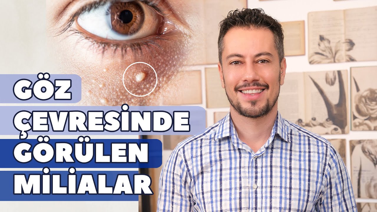 Göz Çevresinde Görülen Milialar