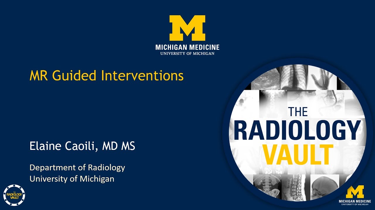 MRI-Guided Interventions