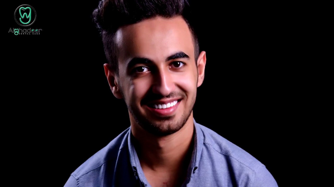 شاهد قصة الرسام محمد على يد الدكتور حسين نعمة والدكتور مهند ماجد | نتيجة روعة | الغدير لطب الاسنان