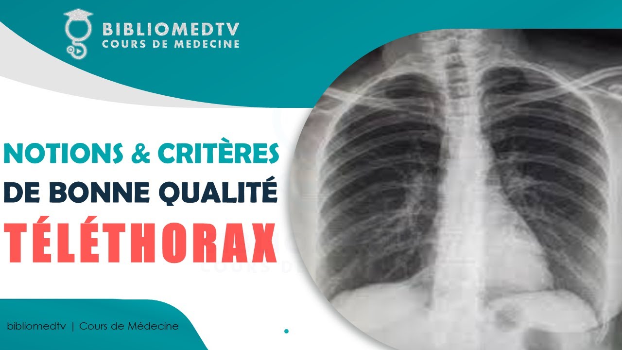Radiographie du Thorax - Notions et Critères de Bonne Qualité
