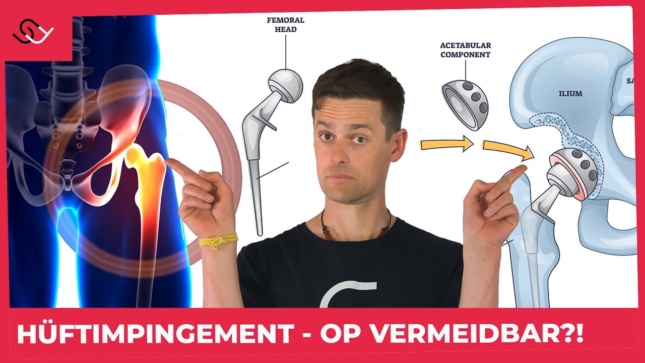Hüftimpingement - Operation unvermeidlich!? Erste Hilfe