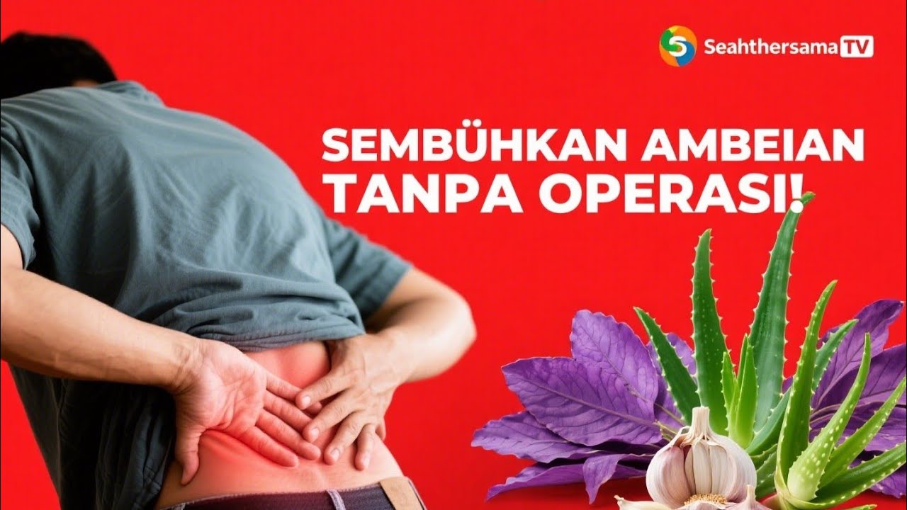 Cara Mengobati Ambeien Parah Secara Alami, Ampuh Tanpa Operasi! | Obat Tradisional Wasir