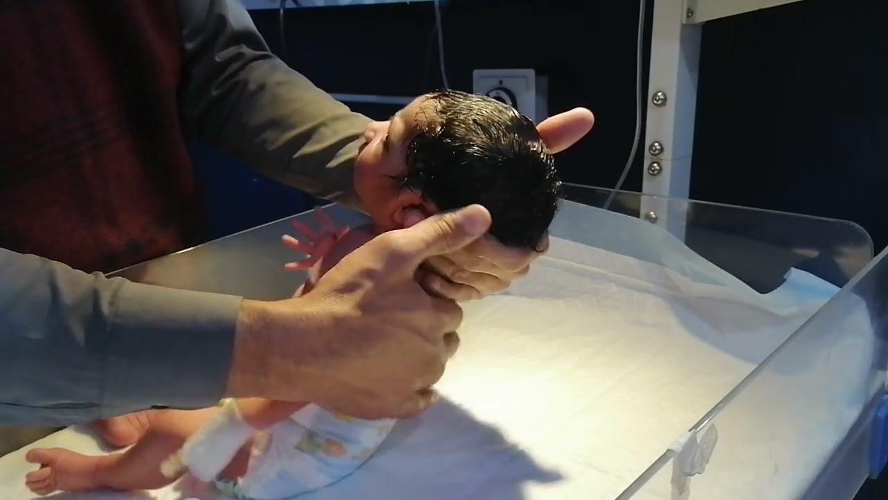 🌸Perfect Bottle Feeding – Newborn Baby with Good Sucking Reflex 🍼💕