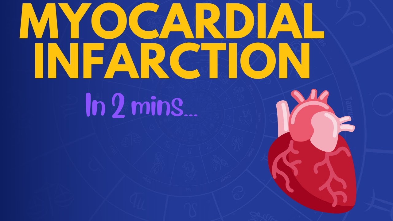 Myocardial Infarction in 2 mins!