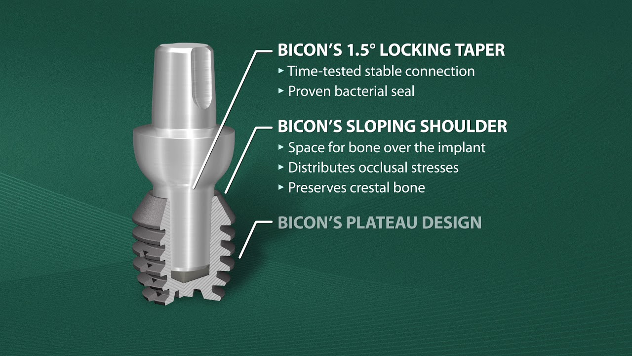 Introduction to Bicon SHORT® Implants [HD]