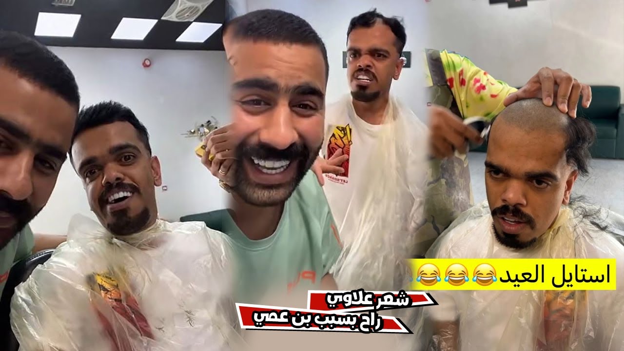 مقلب ازاله الشعر في علاوي