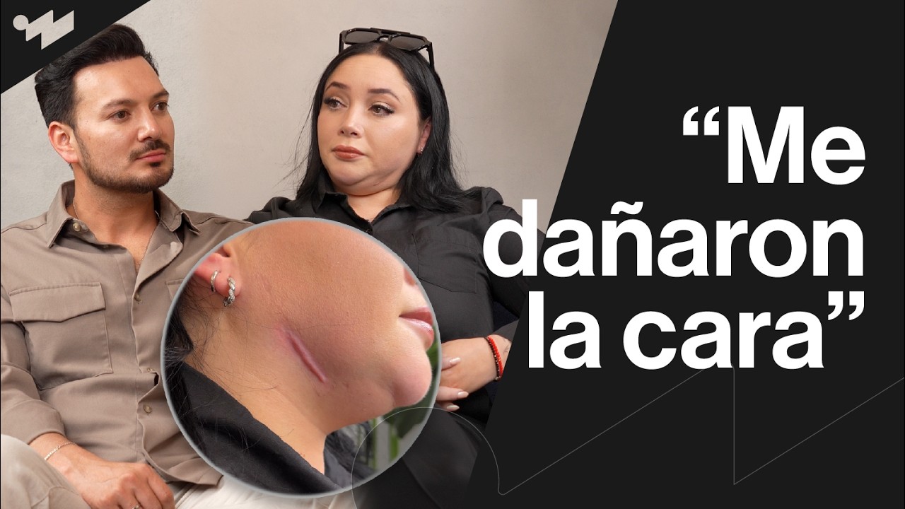Confió en un centro estético y dañaron su rostro | ENTREVISTAS