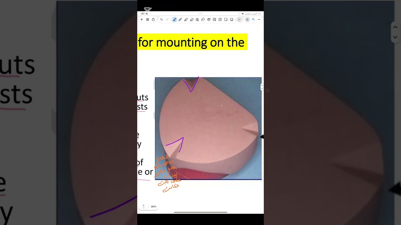 Prosthodontics lec 11طب الاسنان مرحله ثانيه 