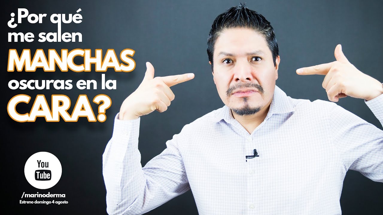 &iquest;Por que me salen manchas oscuras en la cara? Dr Marino dermato&oacute;logo