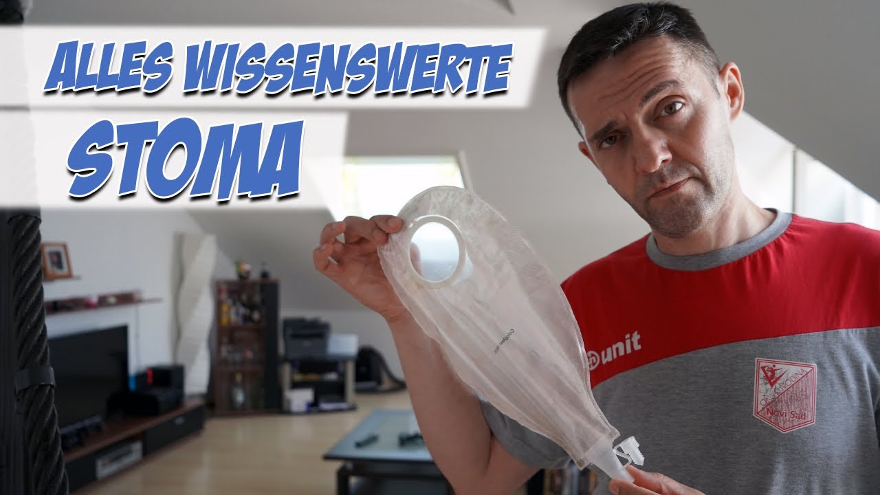 Stoma | Wissenswerte | Pflege Kanal