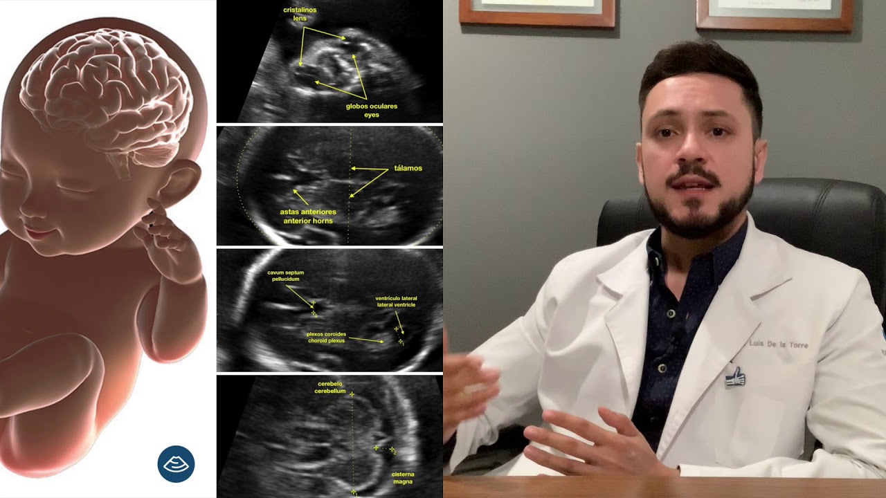 ¿Qué es el ultrasonido estructural o del segundo trimestre del embarazo?