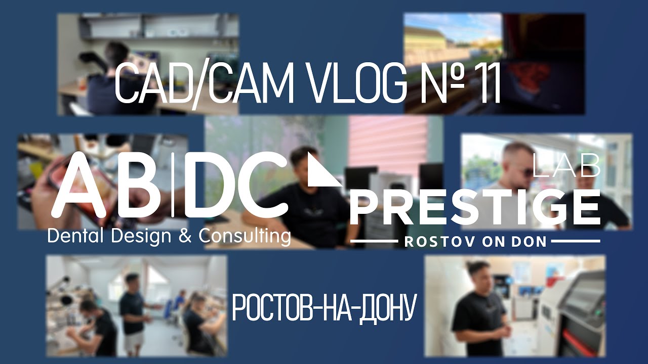 CAD/CAM VLOG 11: PRESTIGE LAB РОСТОВ-НА-ДОНУ