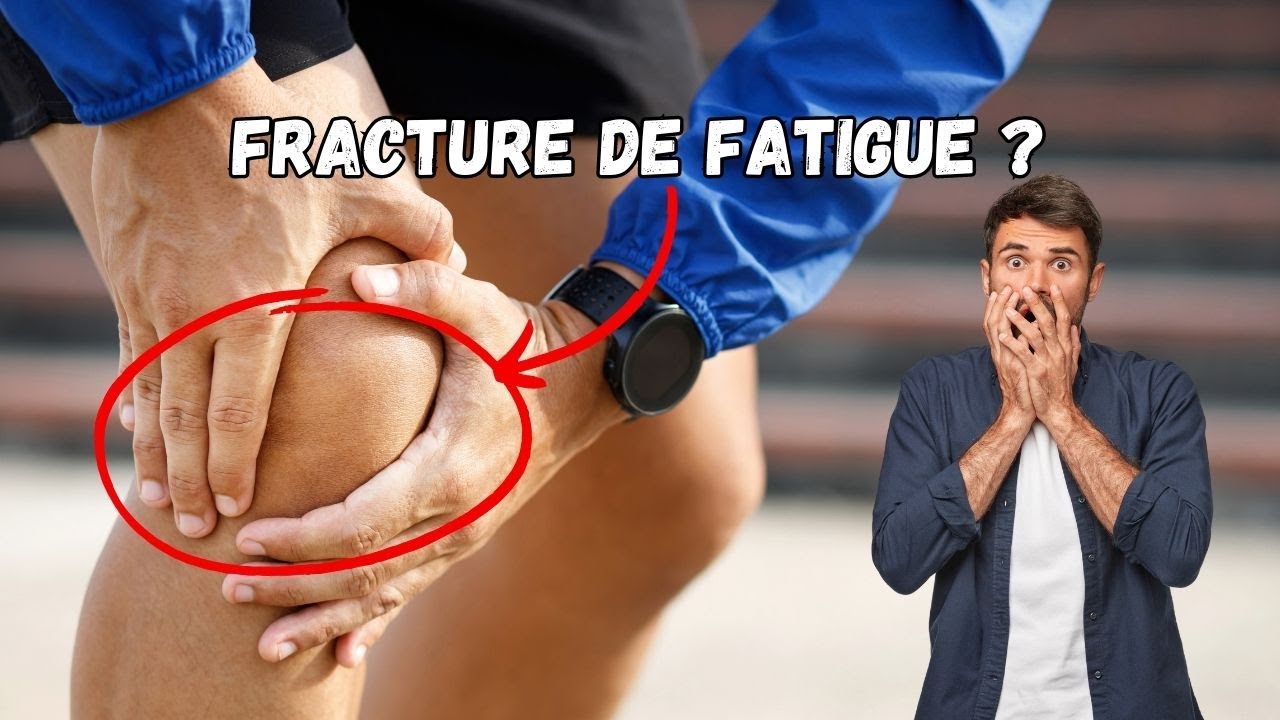 La fracture de fatigue, qu’est-ce que c’est ?