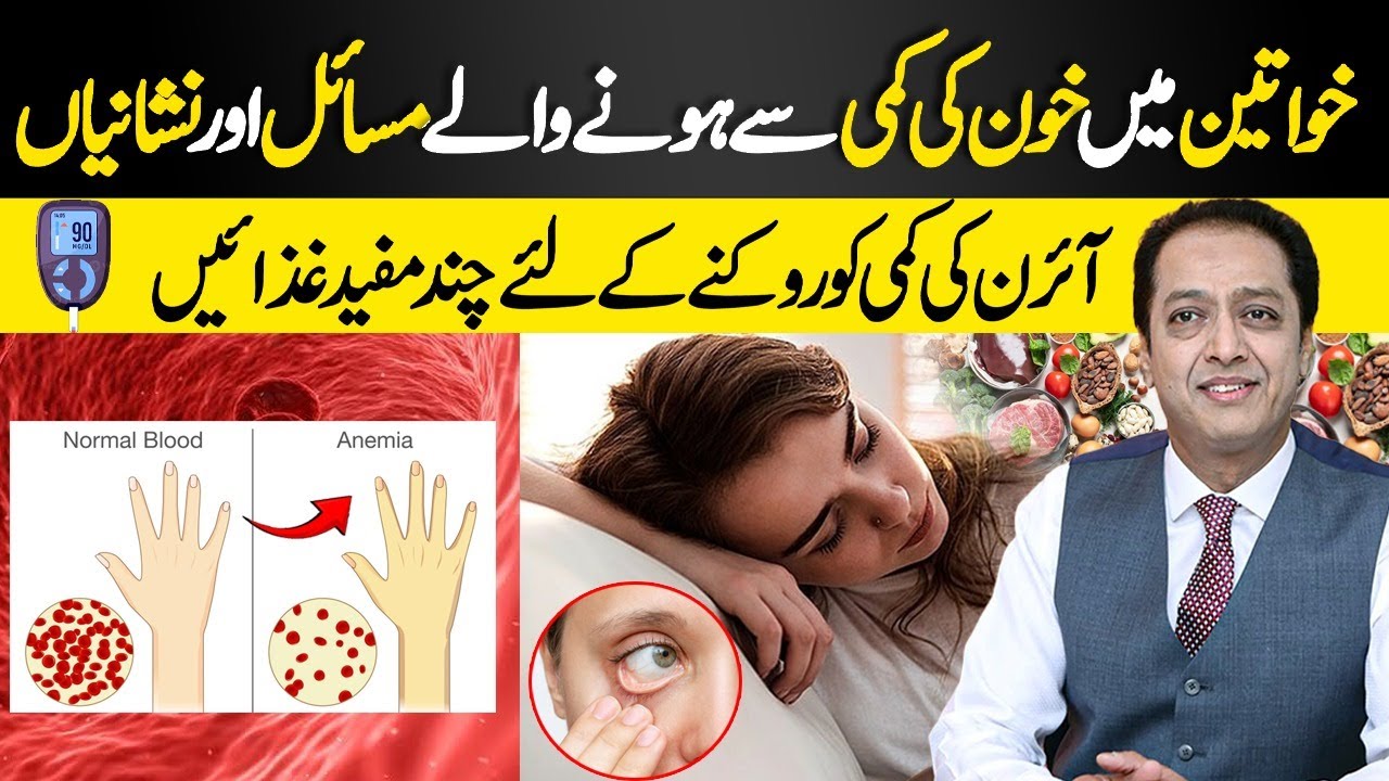 Anemia in women | Signs & Symptoms of Iron Deficiency Anemia in women | Dr Shahid Nadeem