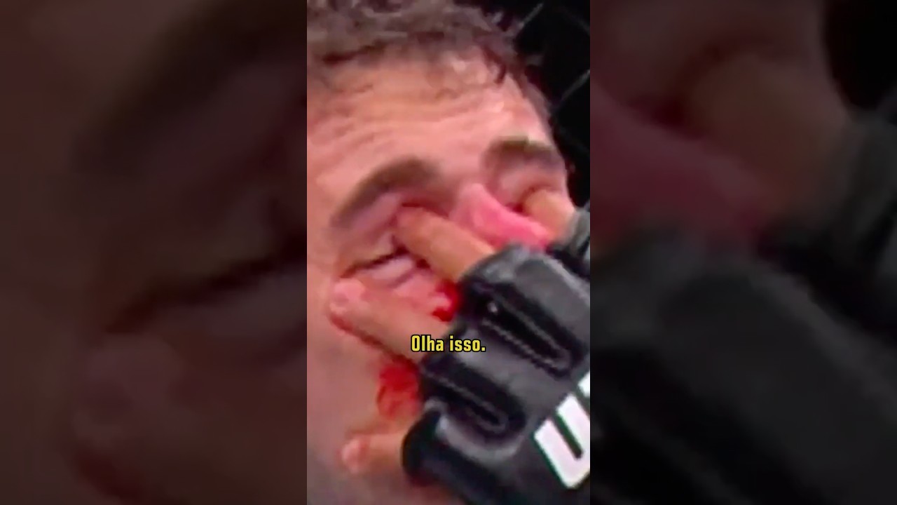 Veja a dedada que causou a interrup&ccedil;&atilde;o da luta entre Tom Aspinall e Ciryl Gane #UFC321 #shorts