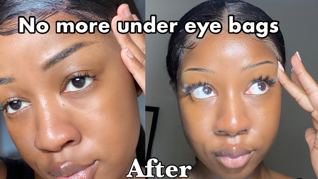 HOW I BRIGHTENED MY DARK CIRCLES!! SIMPLE AND EFFECTIVE ROUTINE (Pictures included)