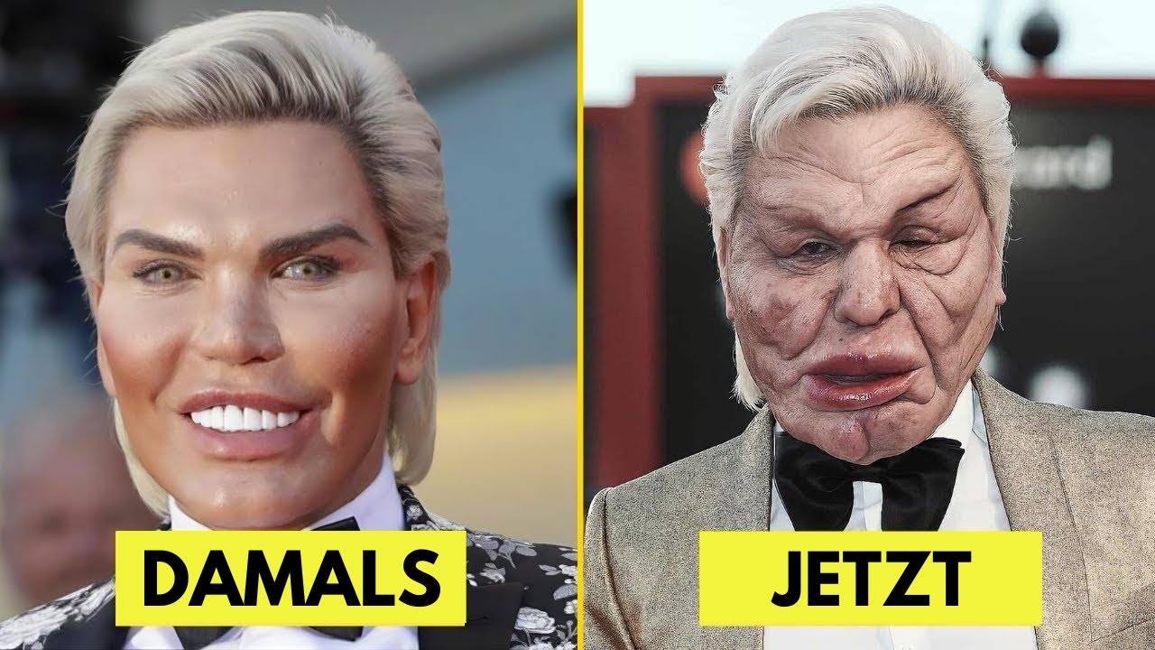 7 Promi-Sch&ouml;nheits-OP-Desaster, bei denen Sie die Stars heute kaum wiedererkennen!