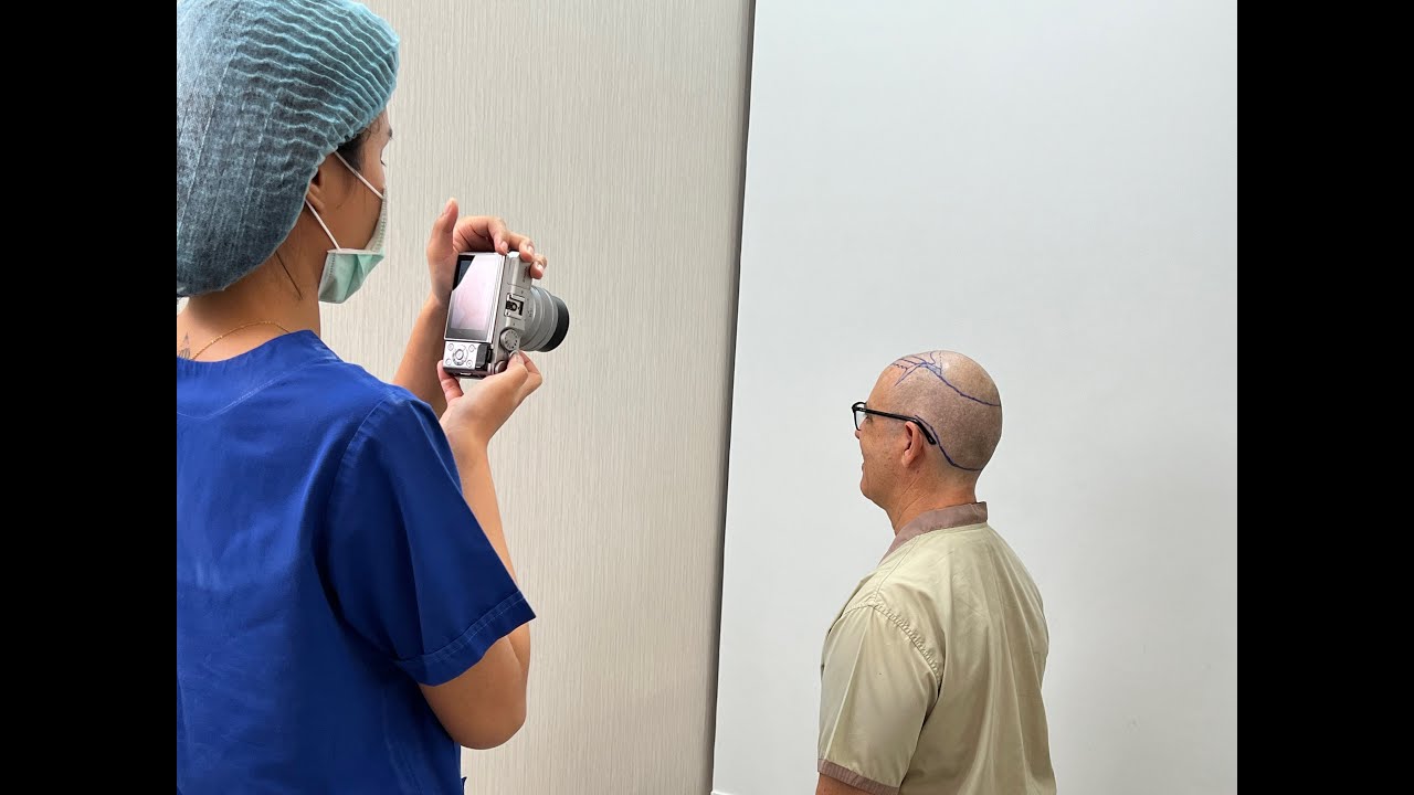 The Start Of My Hair Transplant Journey In Bangkok, Thailand.  Is It The Place To Go? Vlog 76-23