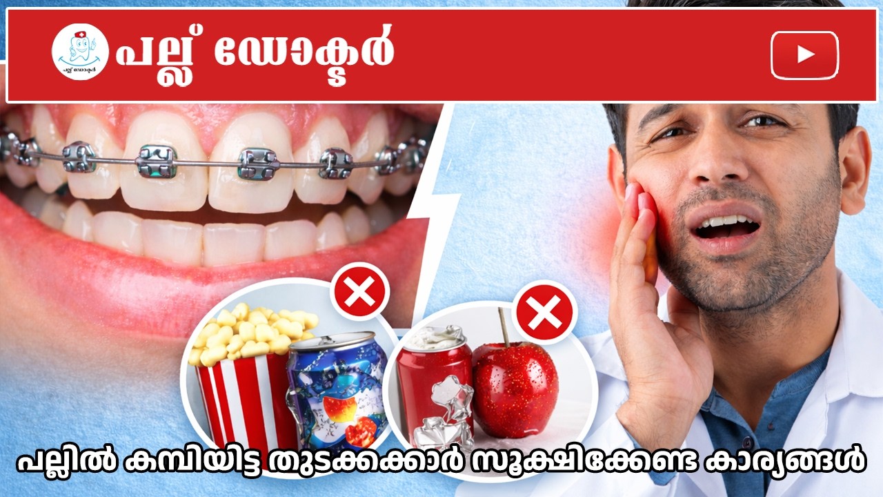 പല്ലിൽ കമ്പിയിട്ടവർ ശ്രദ്ധിക്കൂ! | തുടക്കത്തിൽ സൂക്ഷിക്കേണ്ട കാര്യങ്ങൾ | Pallu Doctor
