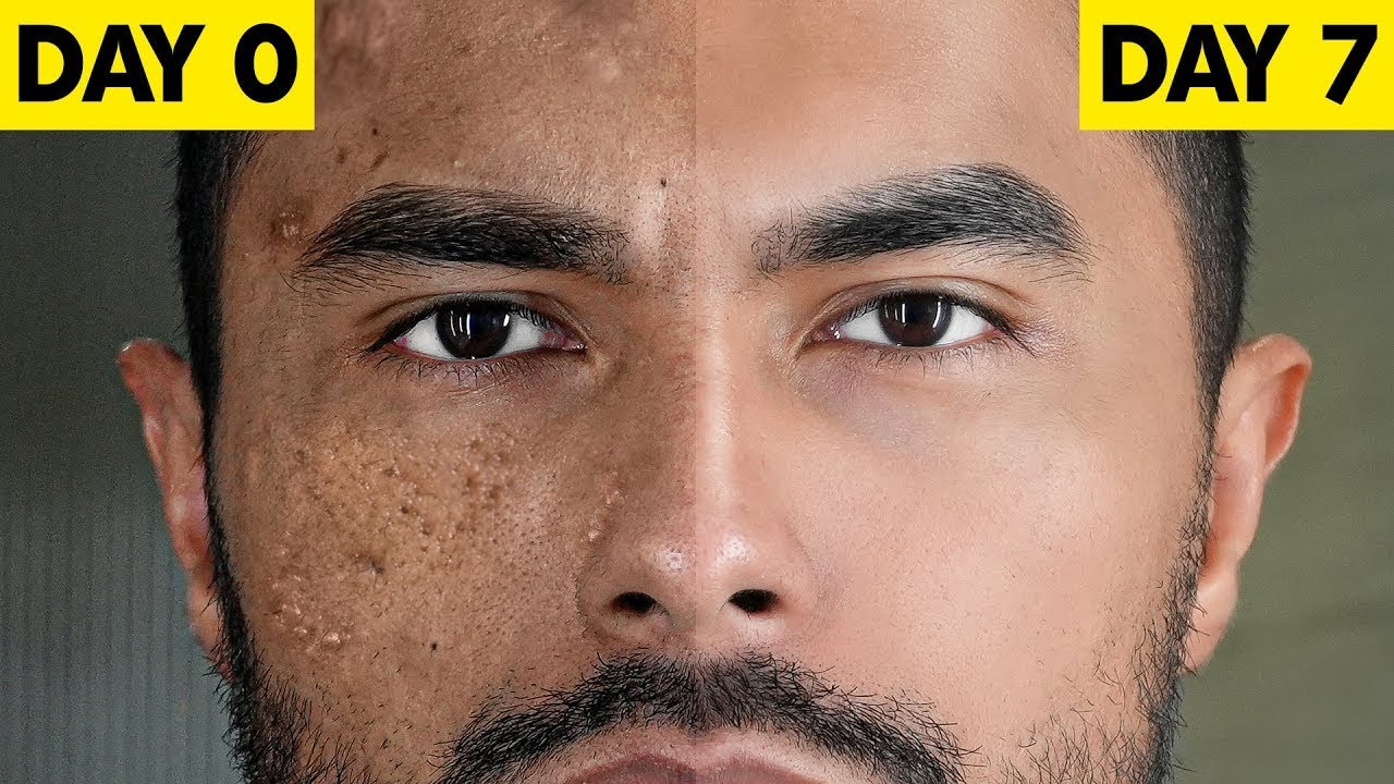 The ONLY Skin Care Routine You Need (Because it's Science Based)