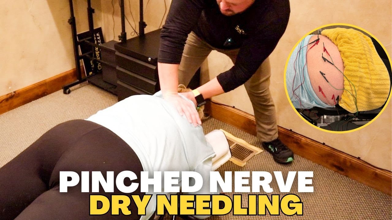 *INSANE* Low Back Adjustment Pinched Nerve & Dry Needling ASMR