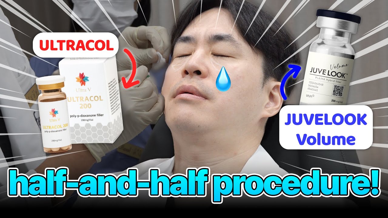 JUVE LOOK Volume vs. ULTRACOL｜Skin booster winner?